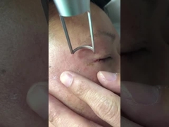 450 추신 피코초 레이저 기계 1064nm 532nm 큐 교환되 Nd 야그