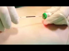 레이저 지방분석 기계